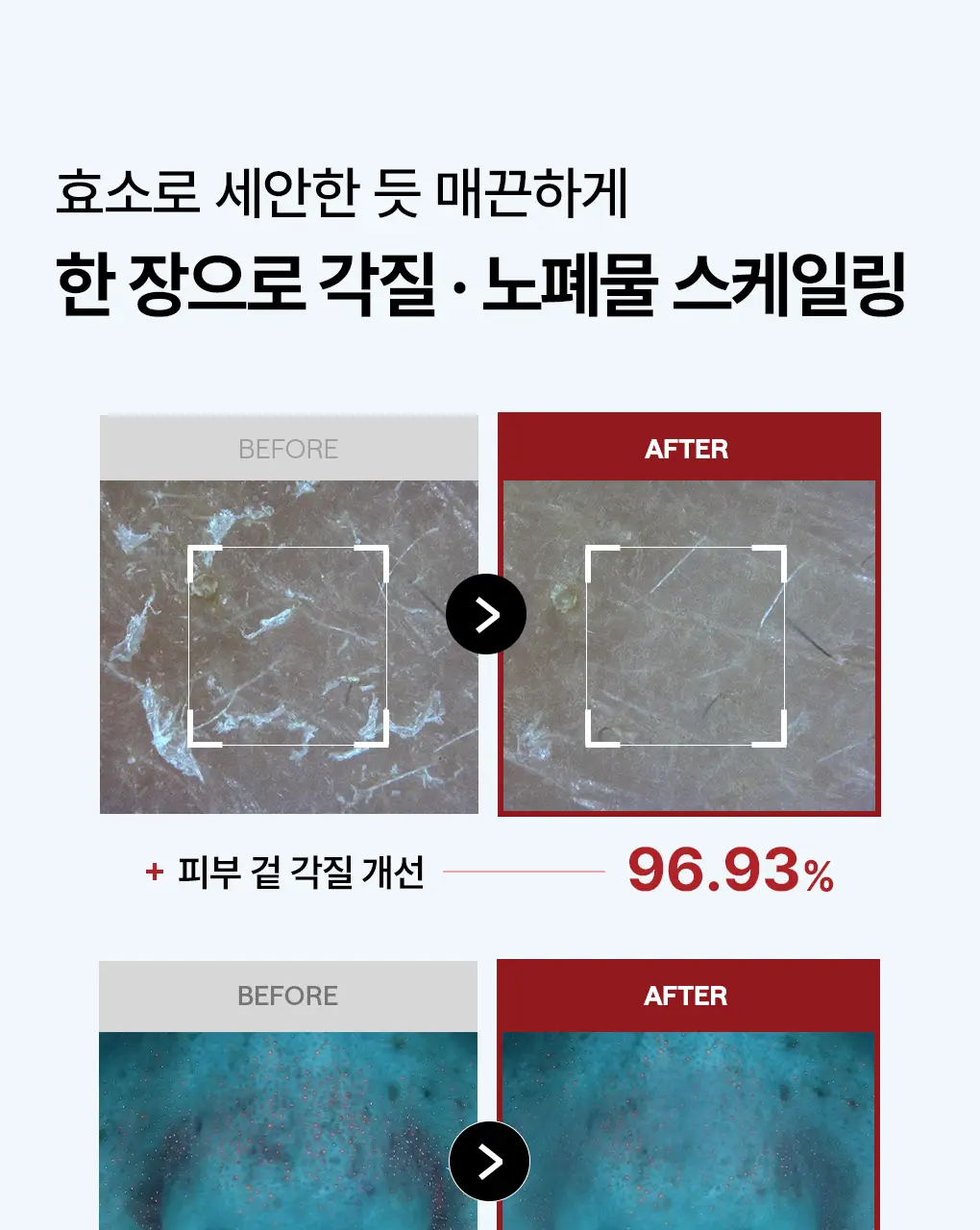 [단독기획] 메디힐 더마 패드 200매 대용량 기획 세트 7종 골라담기 상세페이지 33